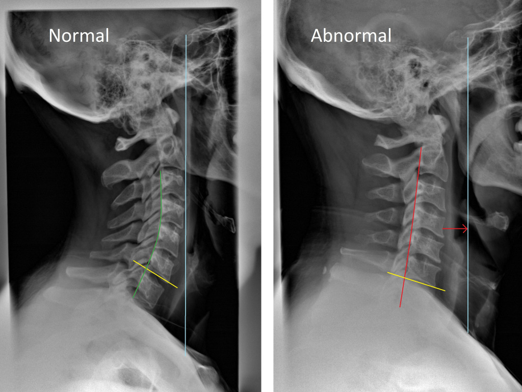 Neck curve